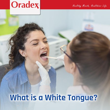 What is a White Tongue?