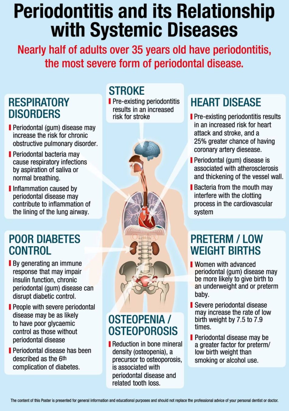 BODY-POSTER-Periodontitis-Medium1-min